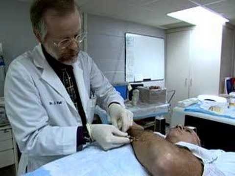 Лечение меланомы в Израиле - лечение рака кожи в клинике Ассута